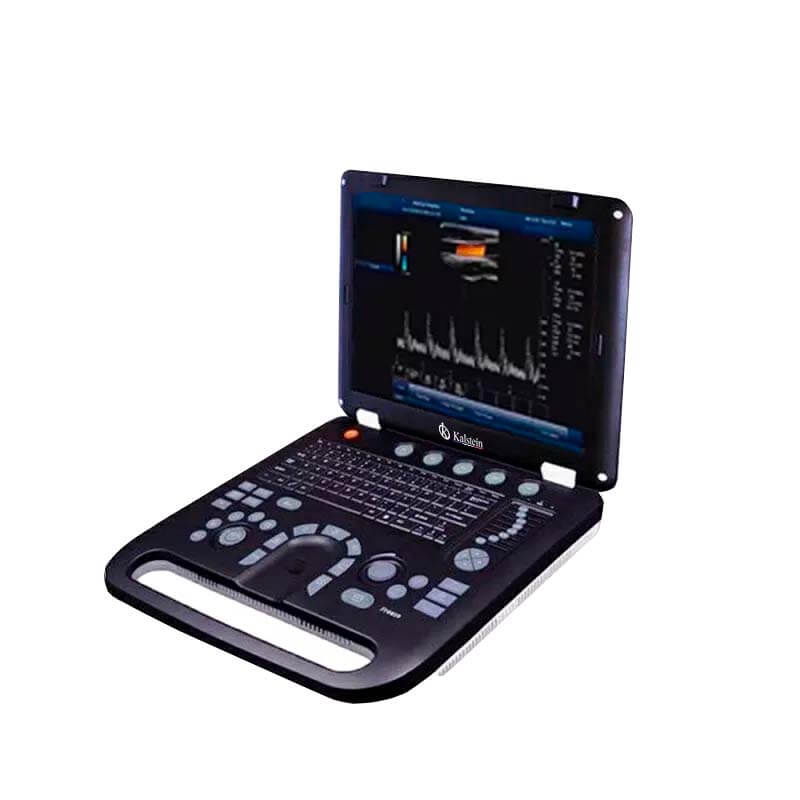 How to Implement Predictive Maintenance and Recommended Calibration for Ultrasonic Color Doppler Diagnostic Systems