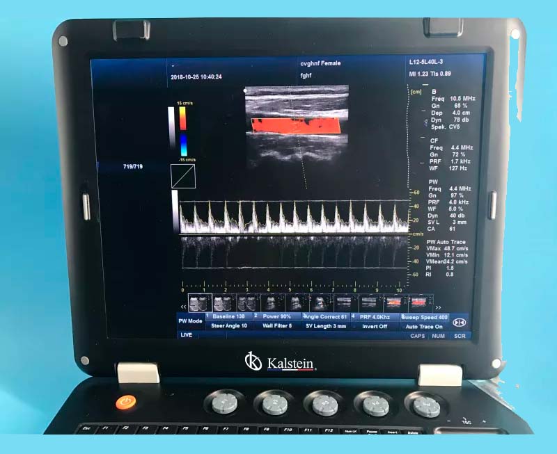 128 Item 3D Medical THI Ultrasound Machine For Sale With Convex Probe YR05148 – 1