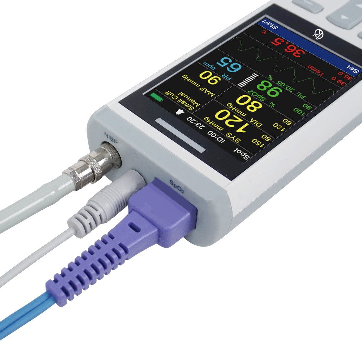 Veterinary Handheld Vital Sign Monitor YR06106 – 1