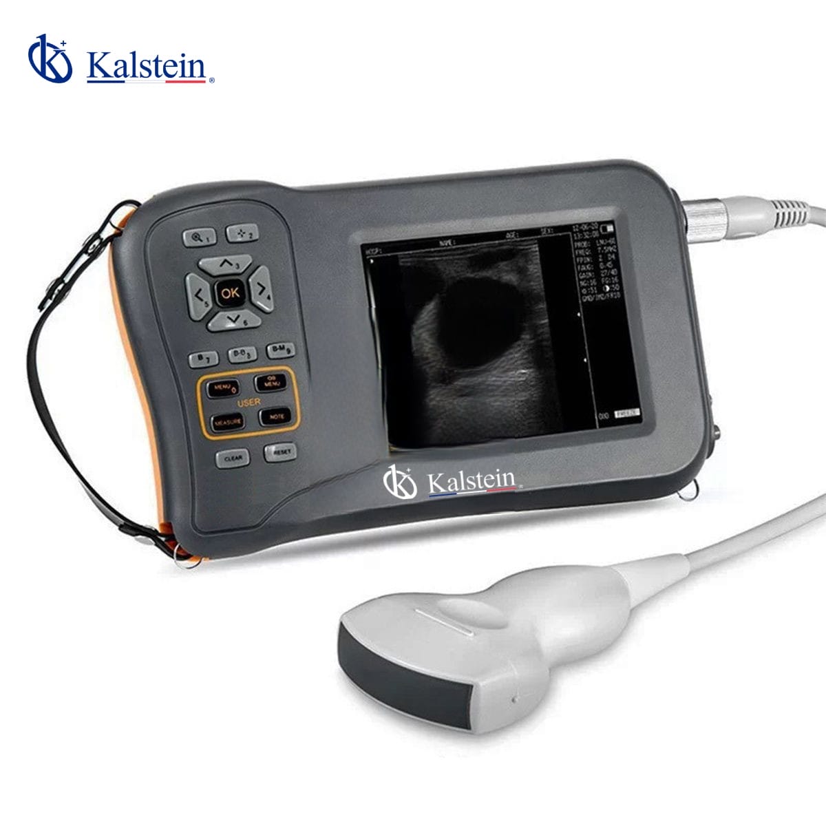 Comparative Analysis of Handheld Veterinary Ultrasound YR06143 by Kalstein vs CTS-800 Ultrasound from Contec